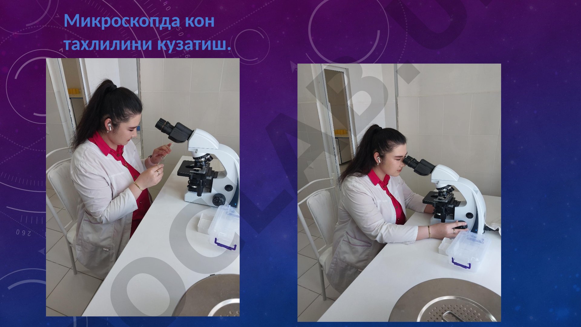 Микроскопда кон тахлилини кузатиш.