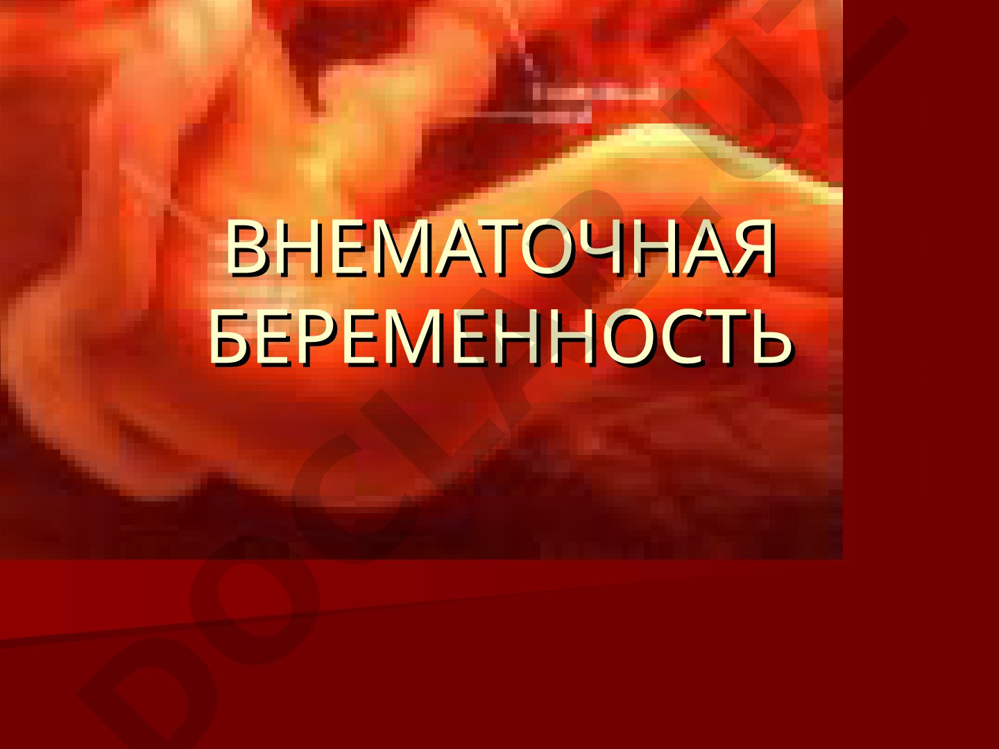 Внематочная беременность