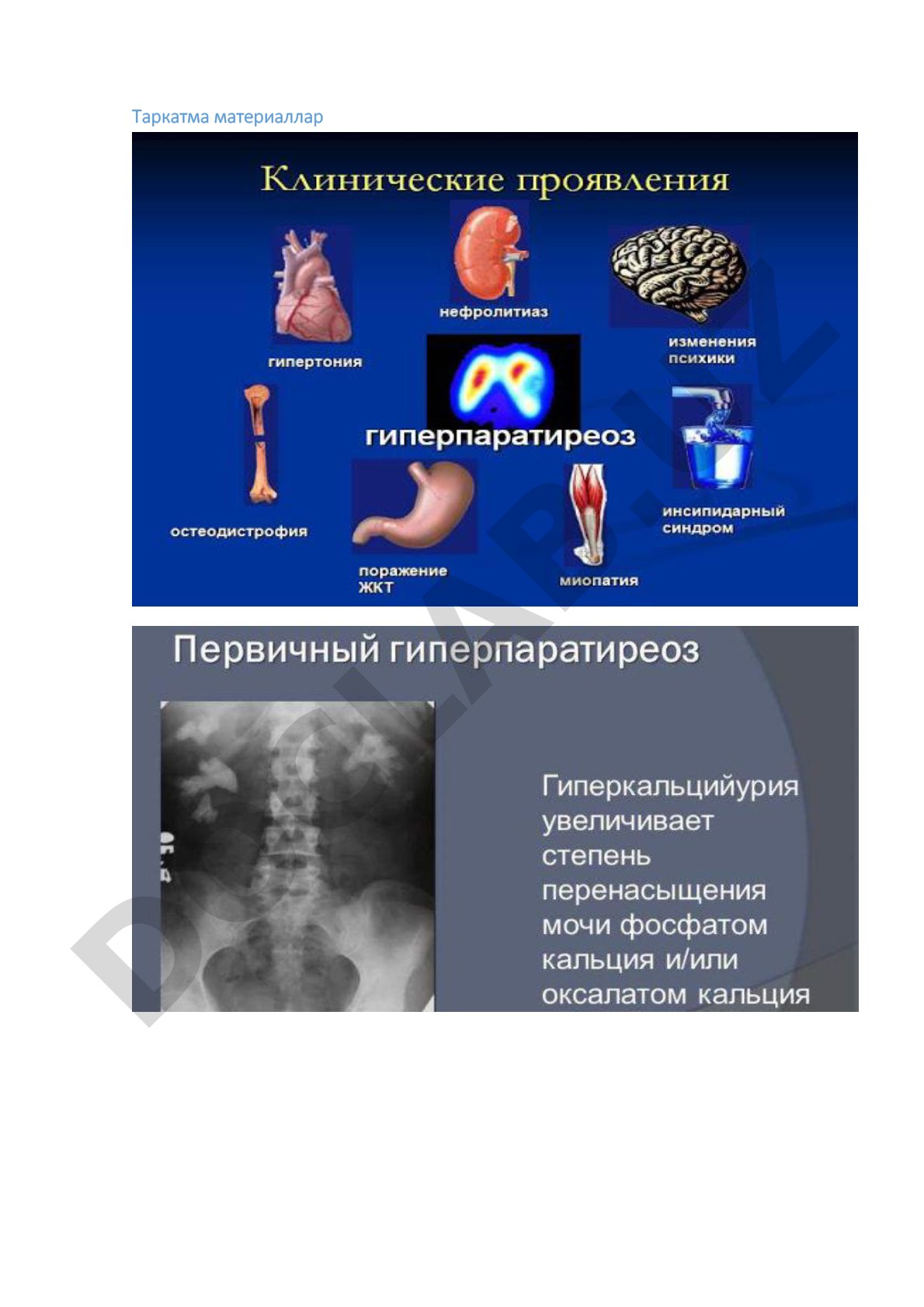Таркатма материаллар