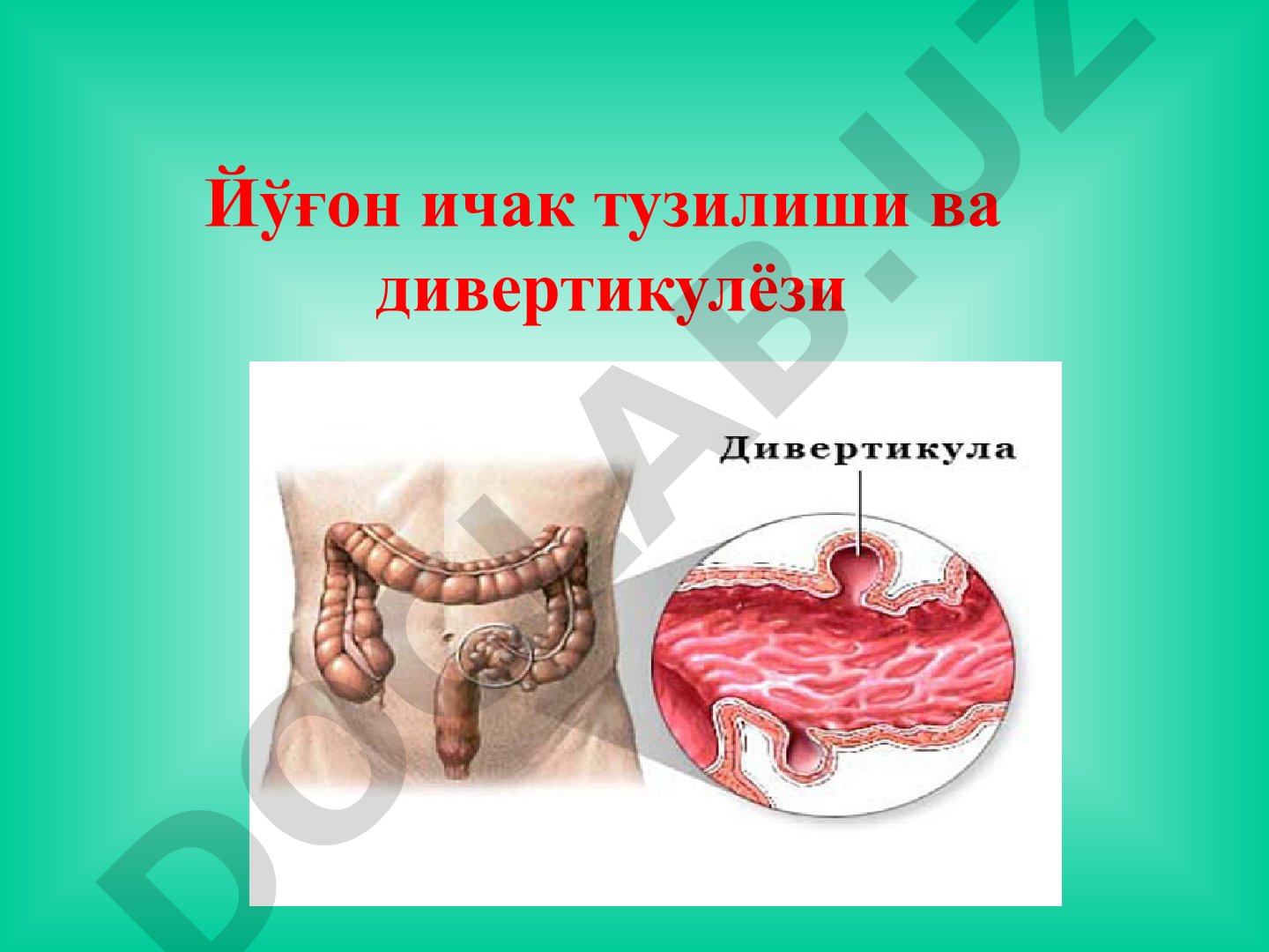 Йўғон ичак тузилиши ва дивертикулёзи