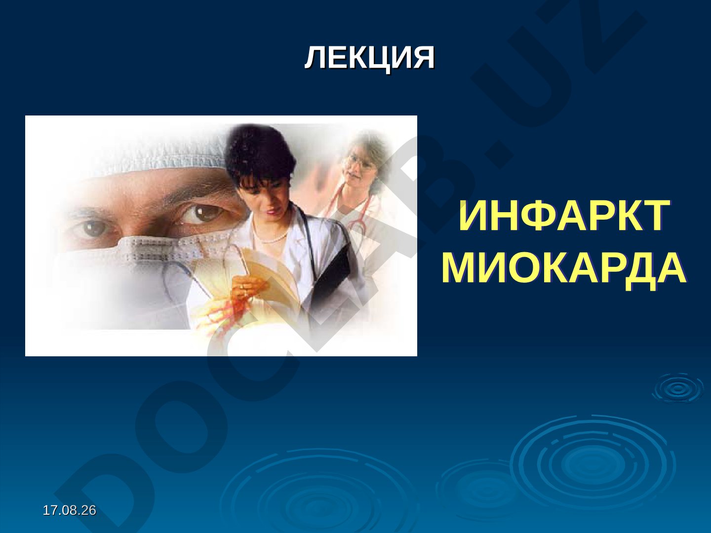 Инфаркт миокарда