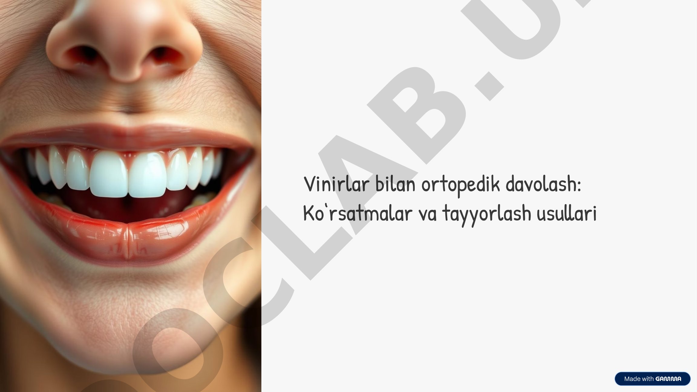 Vinirlar bilan ortopedik davolash ko‘rsatmalari va tayyorlash usullari
