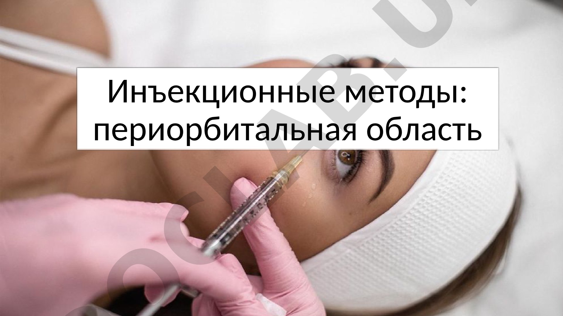 Инъекционные методы в периорбитальной области: преимущества и недостатки