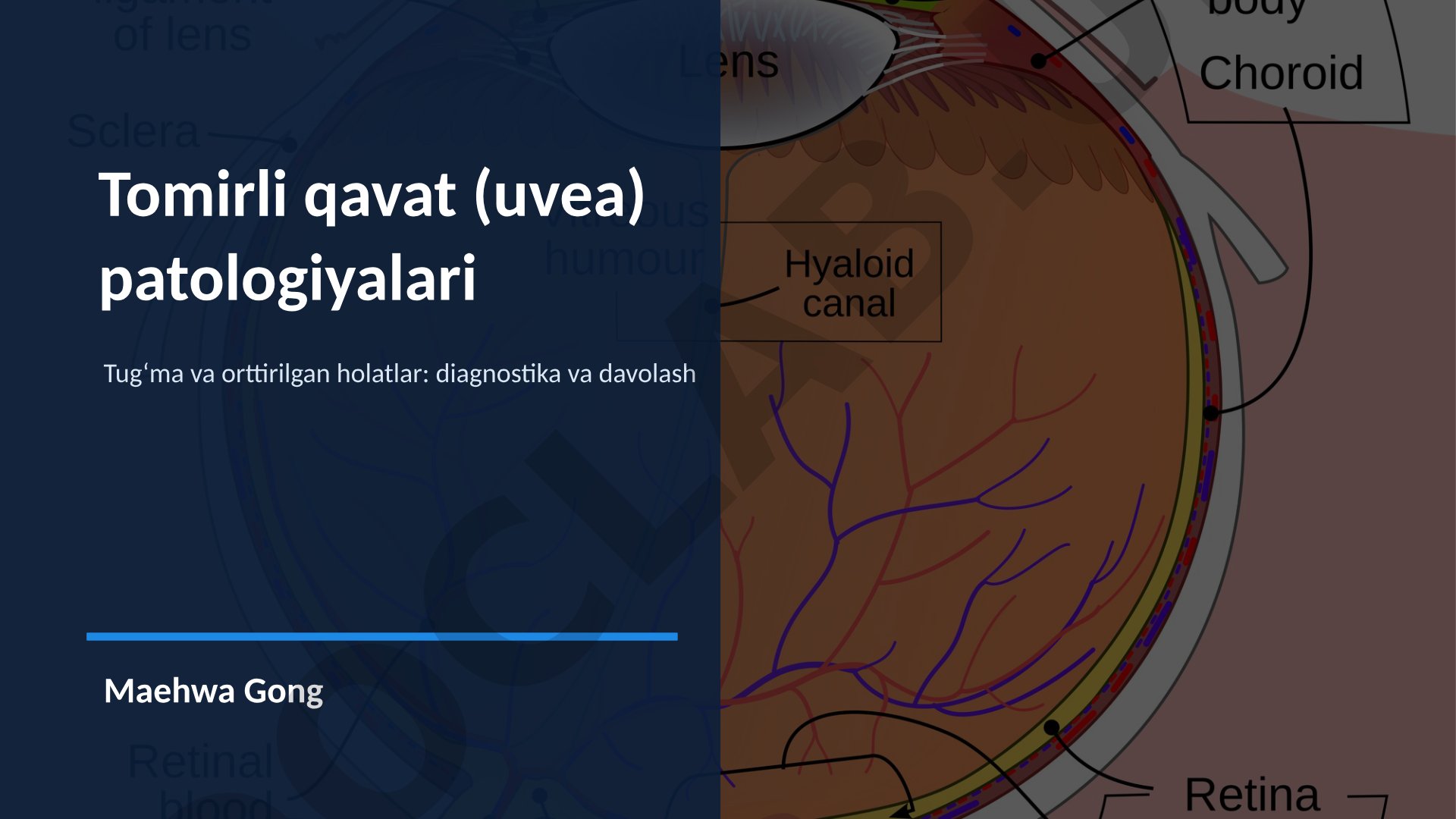 Tomirli qavat (uvea) patologiyalari: tug‘ma va orttirilgan holatlar, diagnostika va davolash