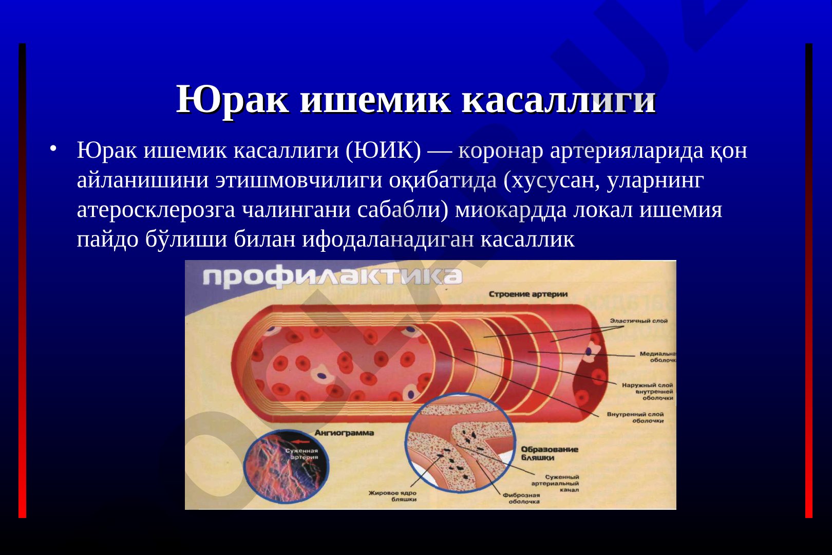 Юрак ишемик касаллиги, даволаш мақсадлари ва дори воситалари ҳақида маълумот
