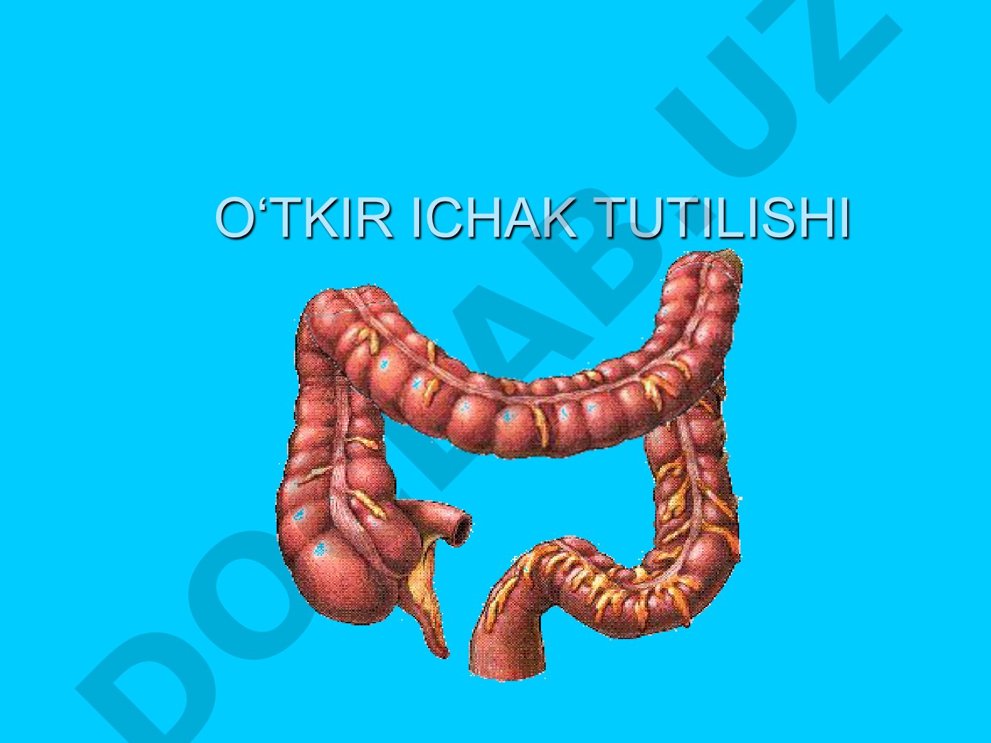 O'tkir ichak tutilishi