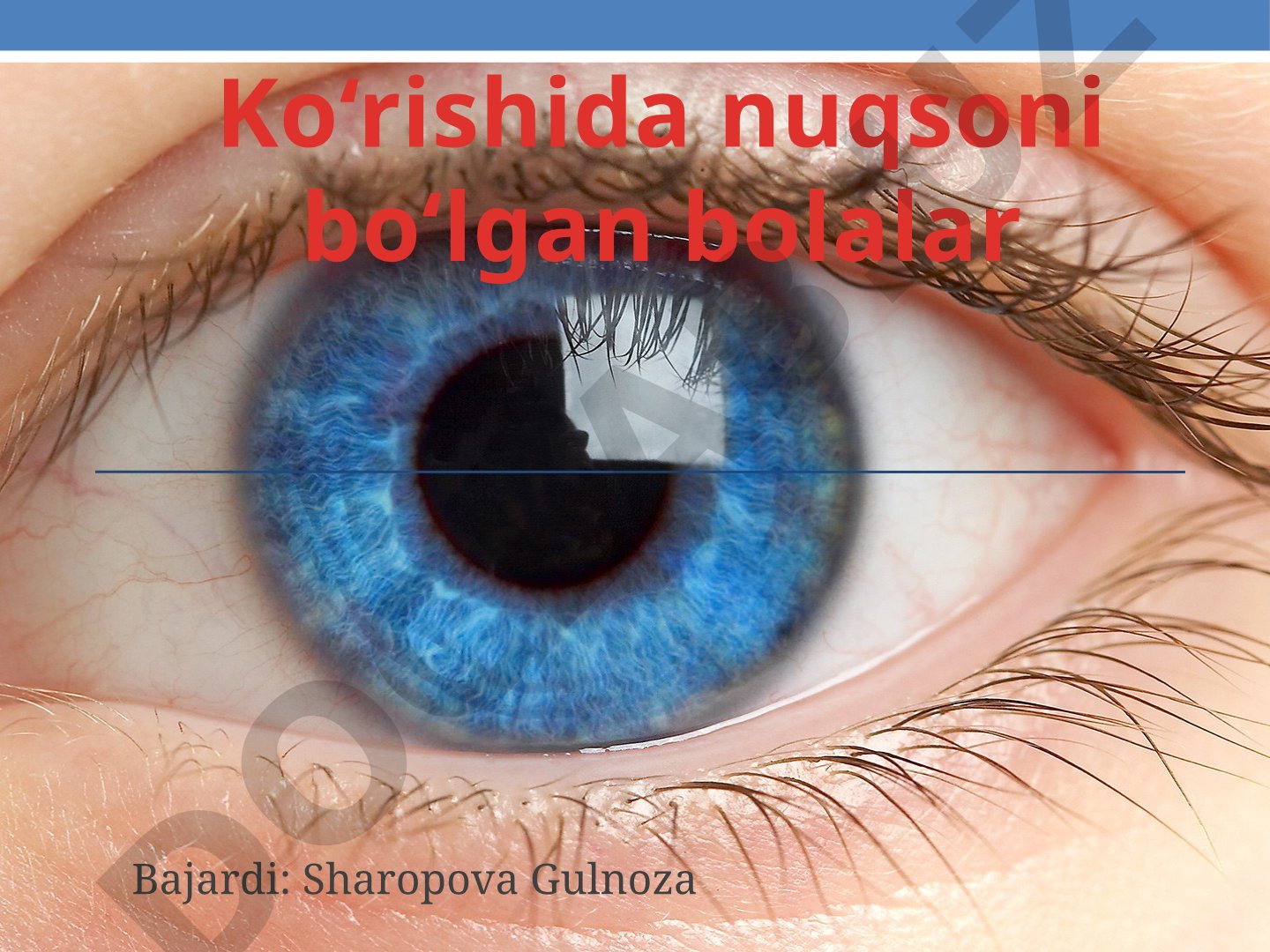 Ko‘rishida nuqsoni bo‘lgan bolalar