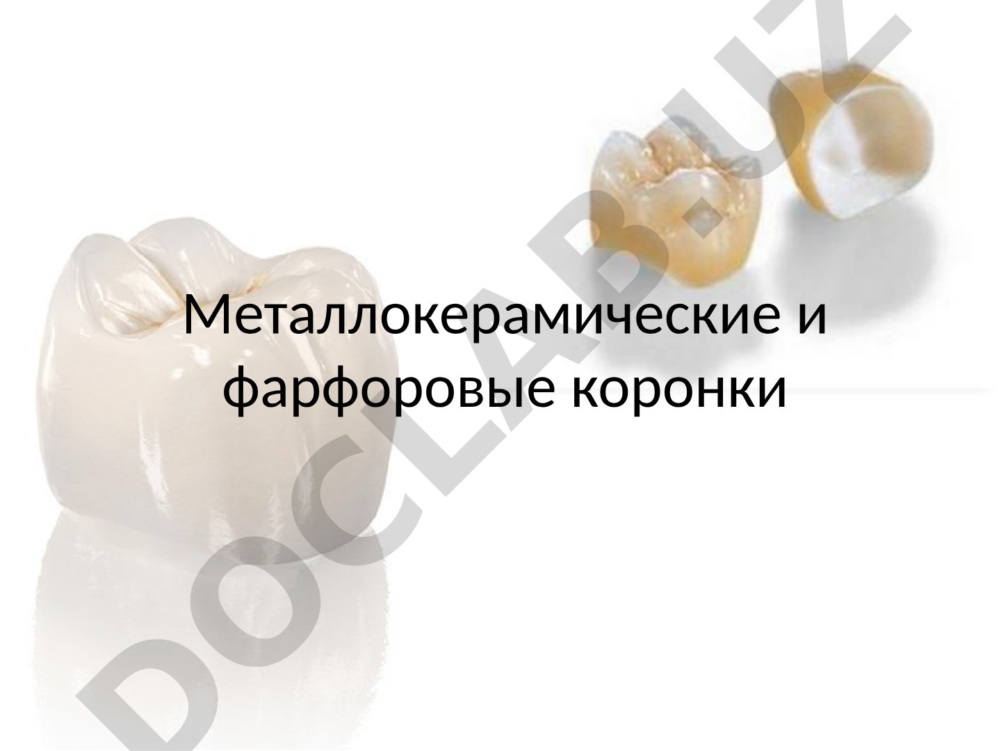Металлокерамические и фарфоровые коронки