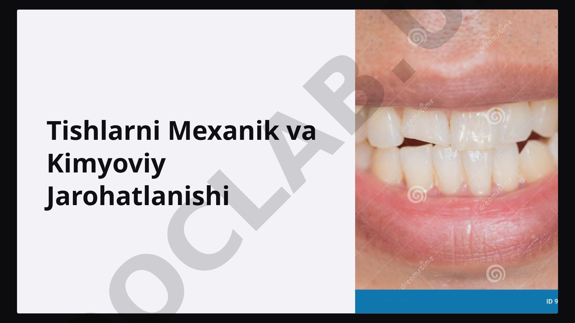 Tishlarni Mexanik va Kimyoviy Jarohatlanishi