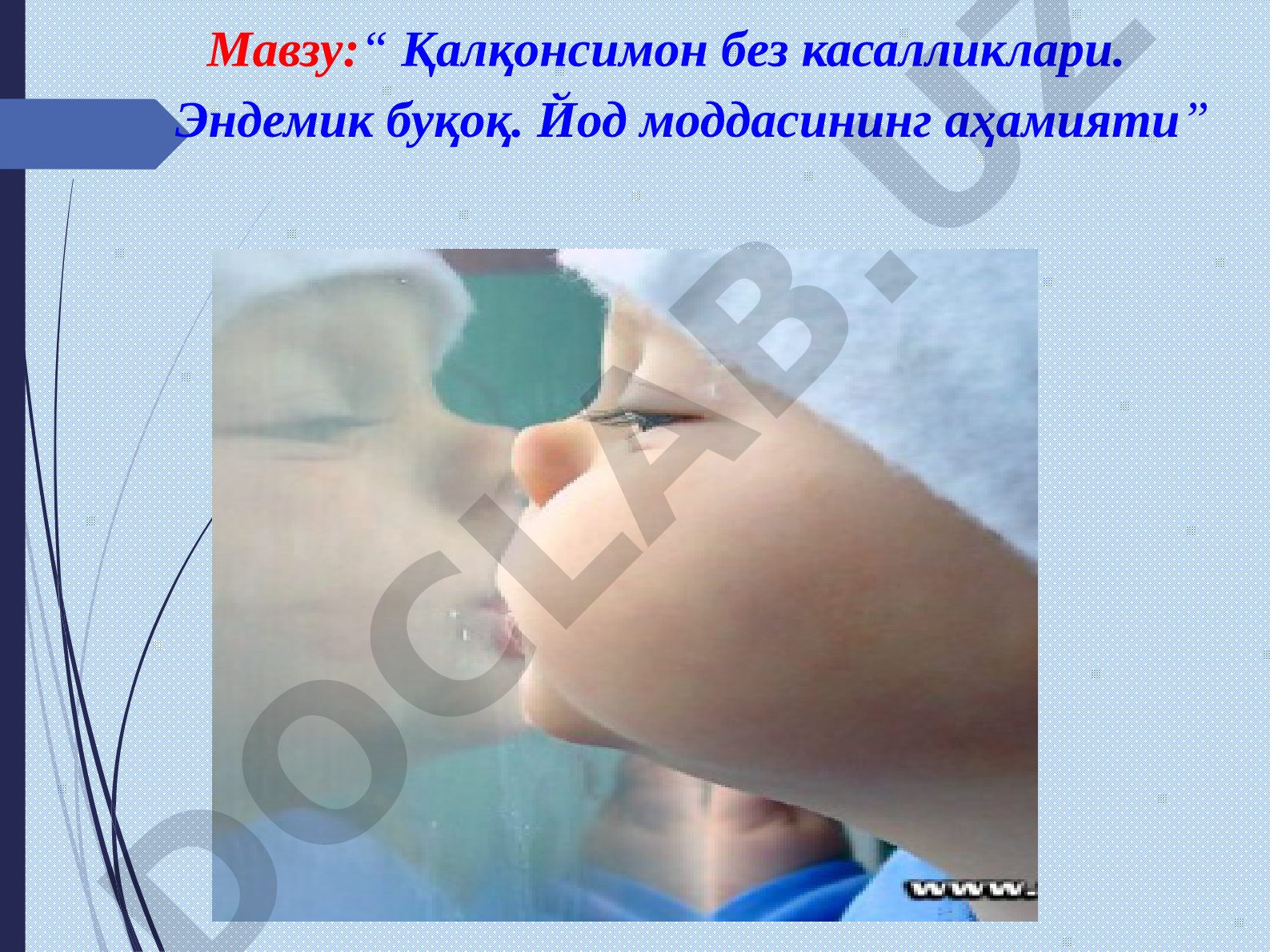 Қалқонсимон без касалликлари. Эндемик буқоқ. Йод моддасининг аҳамияти
