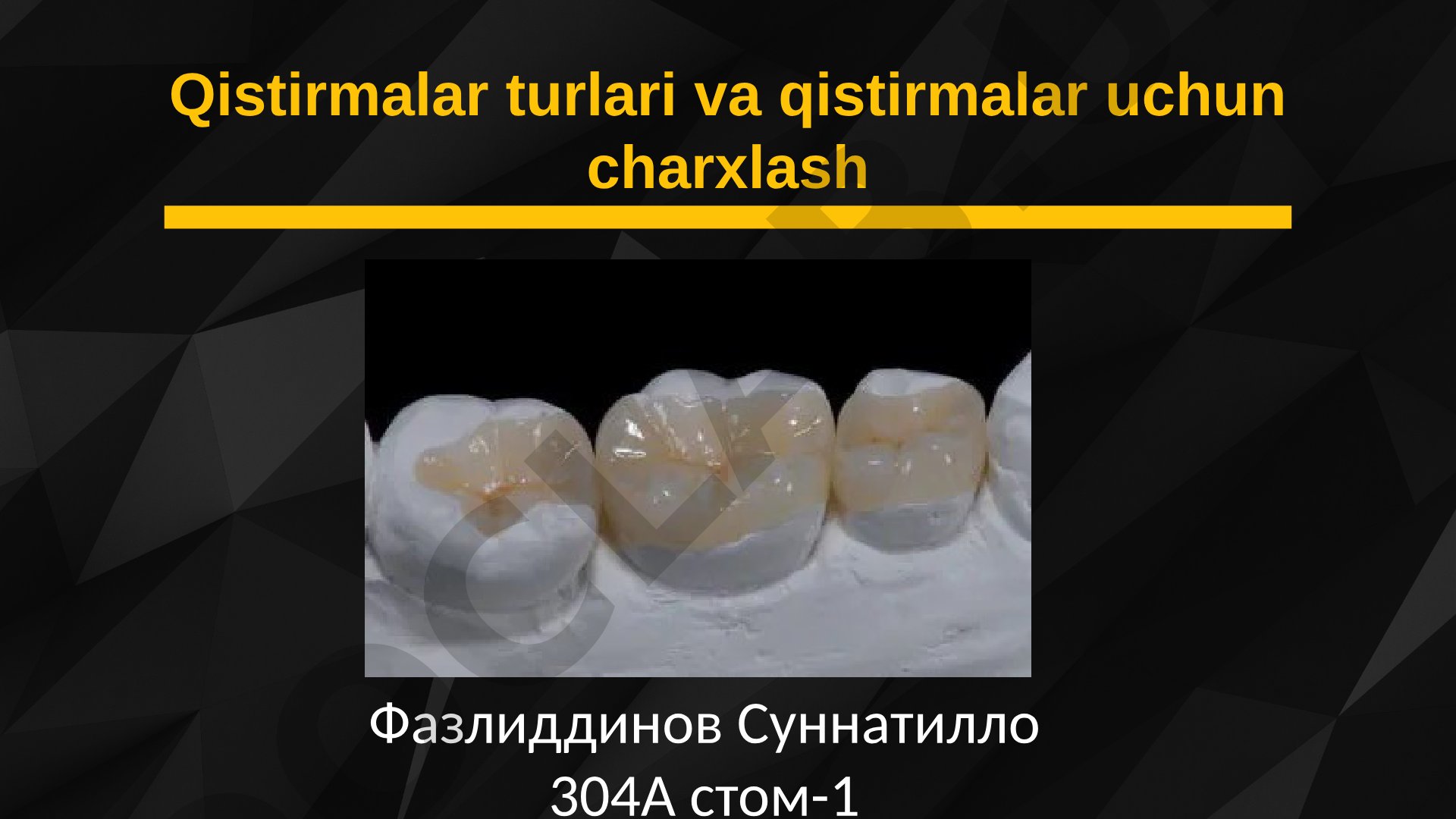 Qistirmalar turlari va ularning tasnifi