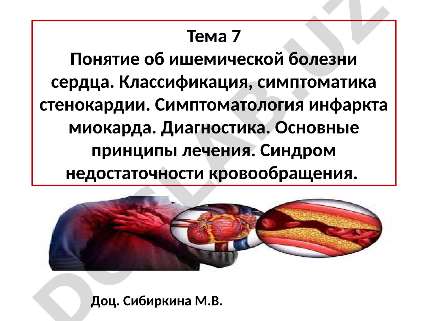Ишемическая болезнь сердца: классификация, симптоматика, диагностика, лечение