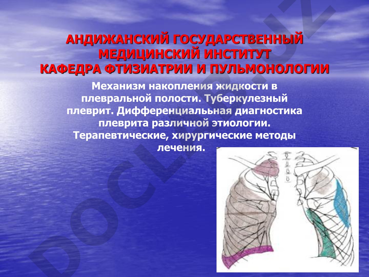 Плевриты: механизм накопления жидкости, дифференциальная диагностика и лечение