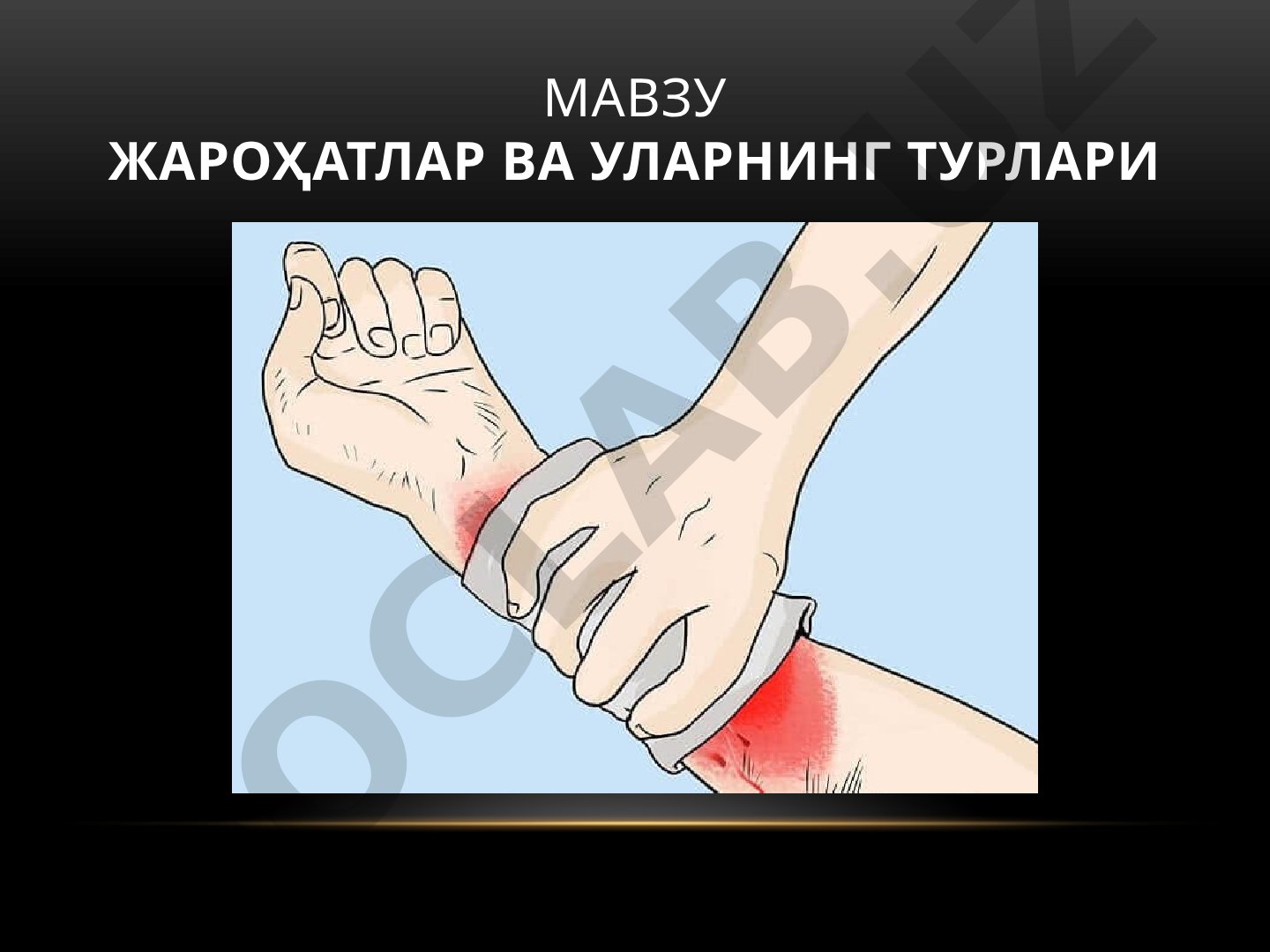Жароҳатлар ва уларнинг турлари