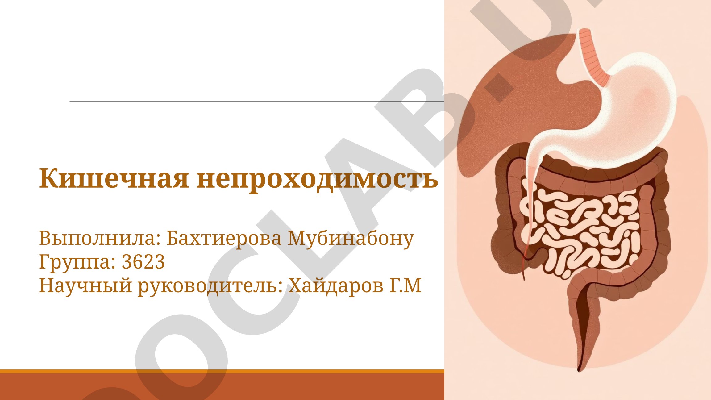 Кишечная непроходимость
