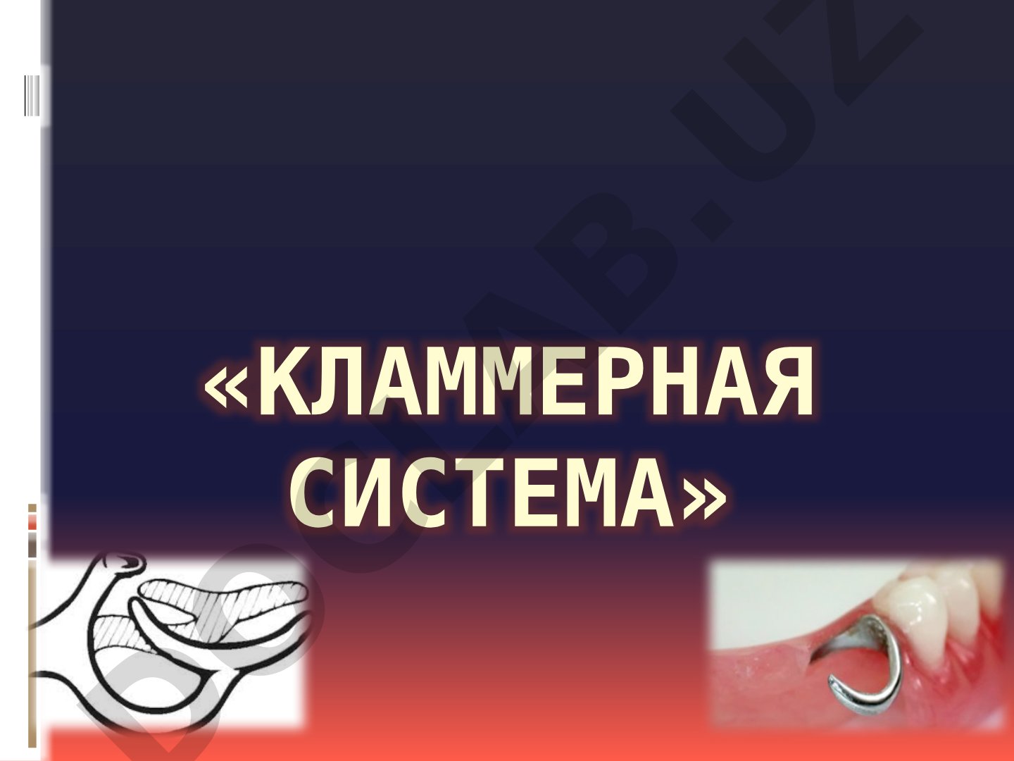 Кламмерная система