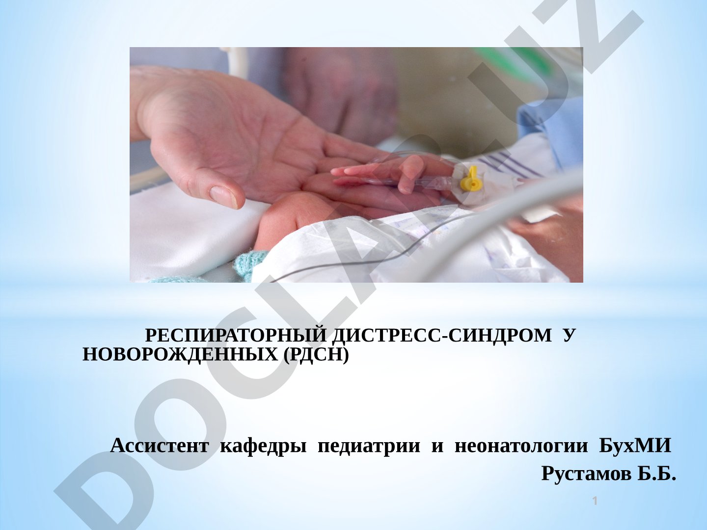 Респираторный дистресс-синдром у новорожденных