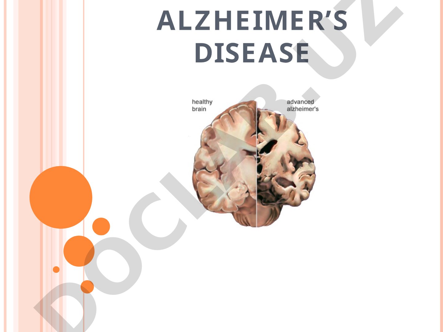 Overview of Alzheimer's disease: prevalence, symptoms, diagnosis, causes, treatment, and