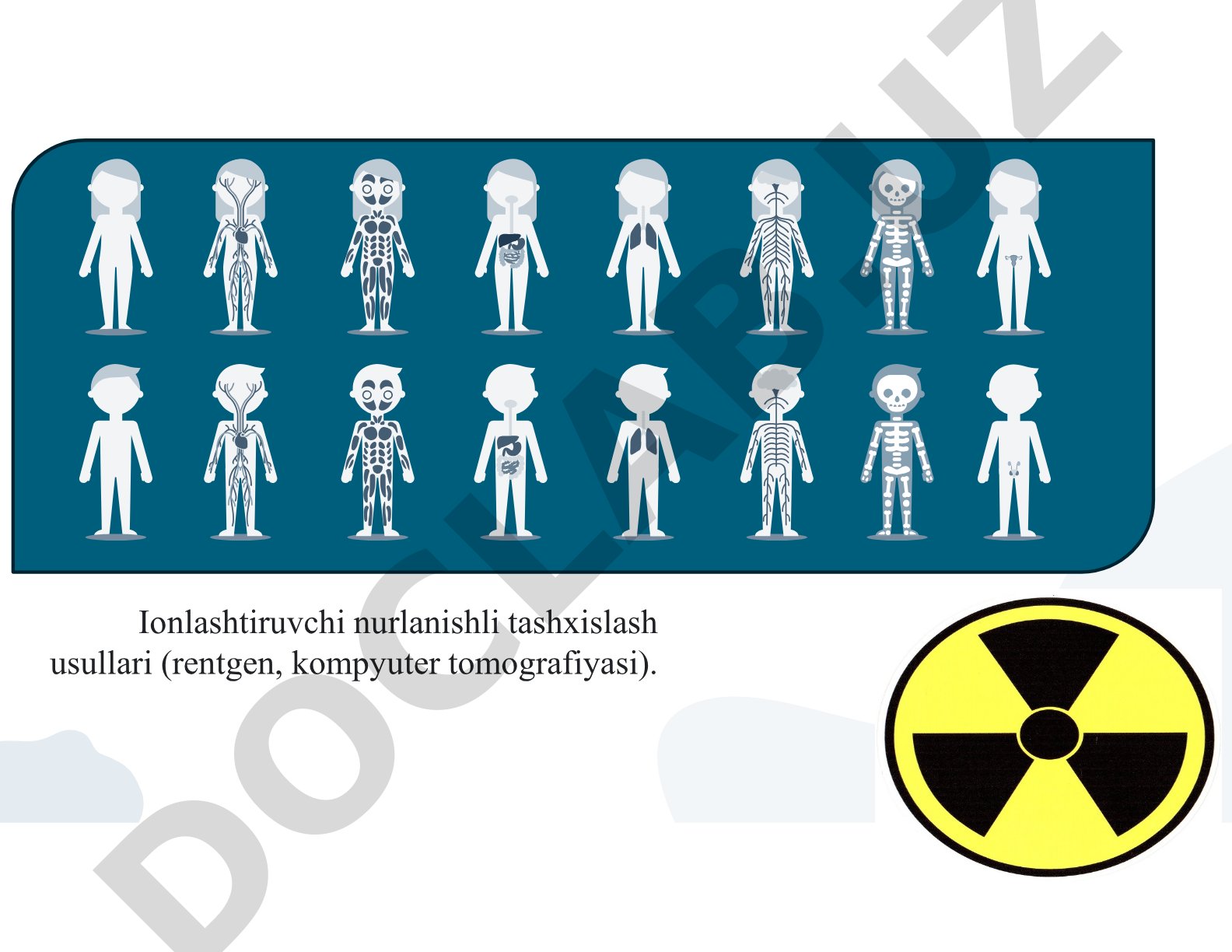 Ionlashtiruvchi nurlanishli tashxislash usullari (rentgen, kompyuter tomografiyasi)