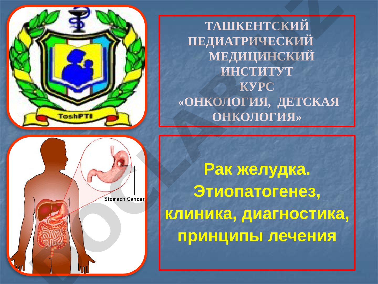Рак желудка. Этиопатогенез, клиника, диагностика, принципы лечения