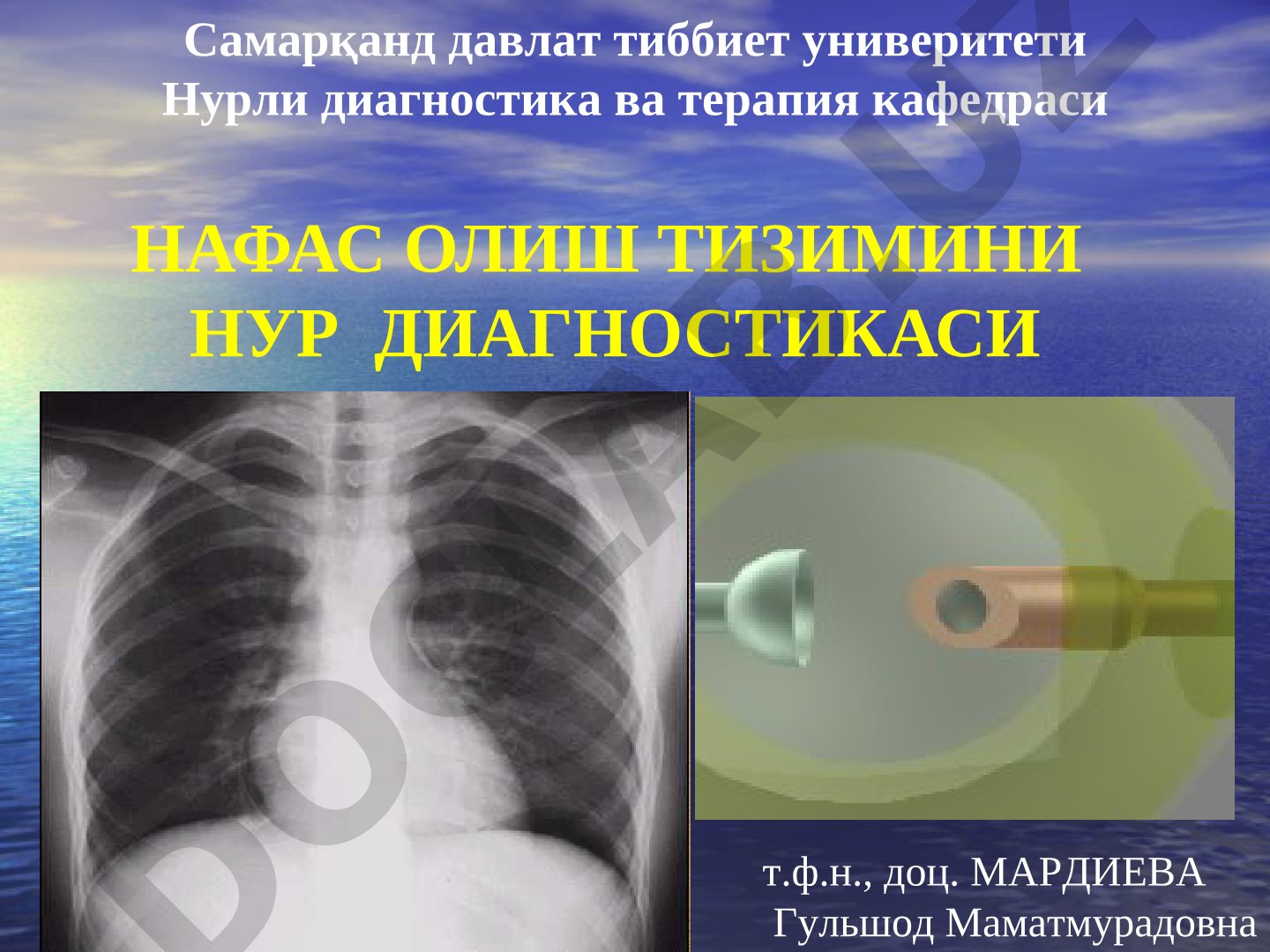 НАФАС ОЛИШ ТИЗИМИНИ НУР ДИАГНОСТИКАСИ