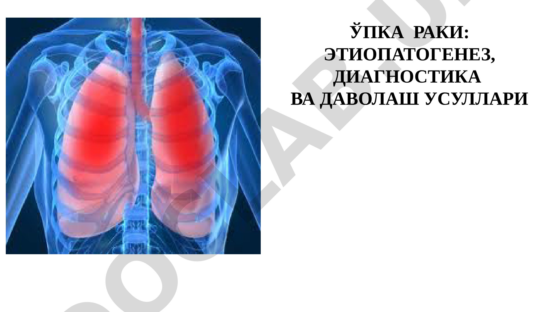 Ўпка раки: этиопатогенез, диагностика ва даволаш усуллари