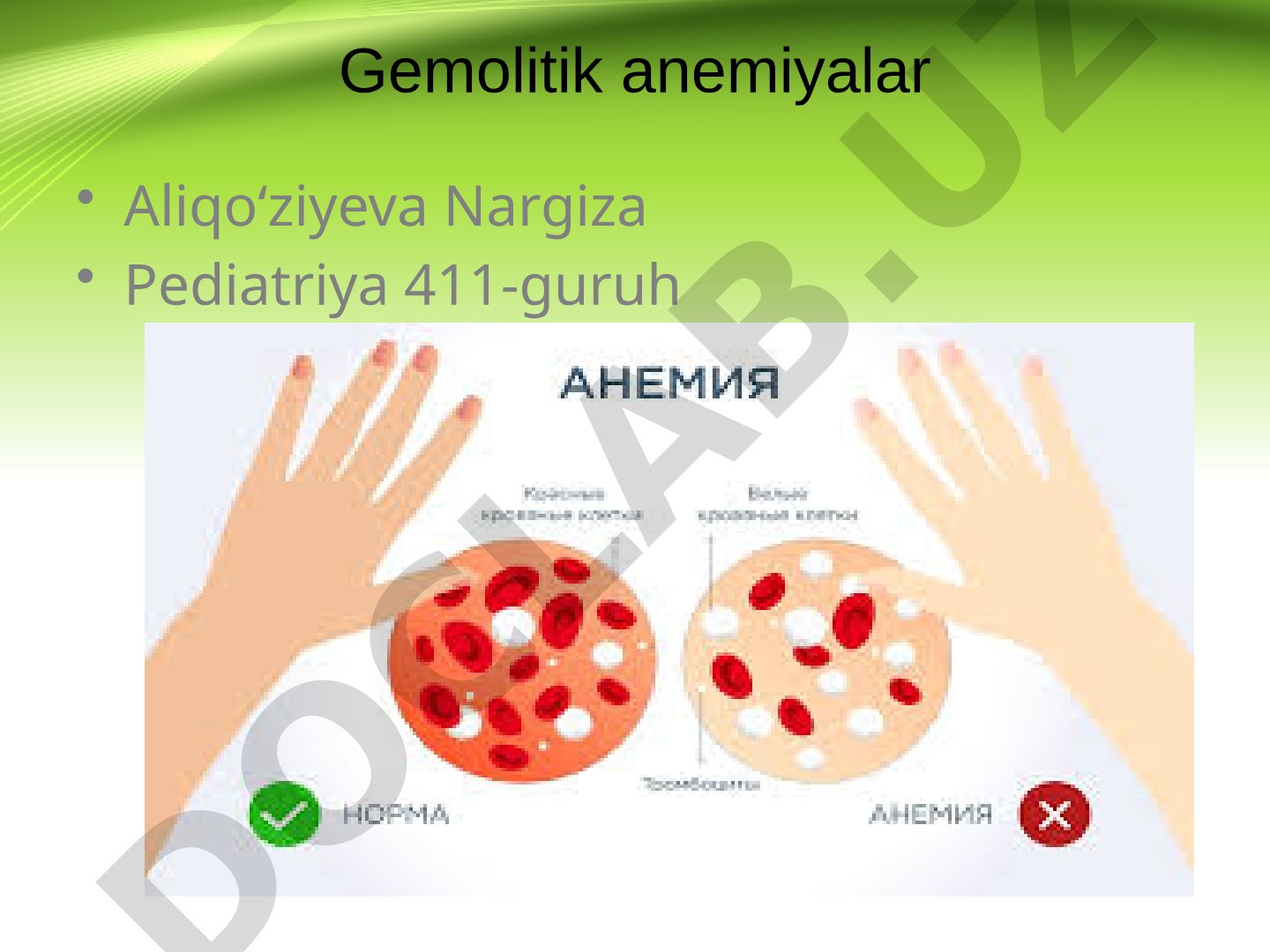 Gemolitik anemiyalar