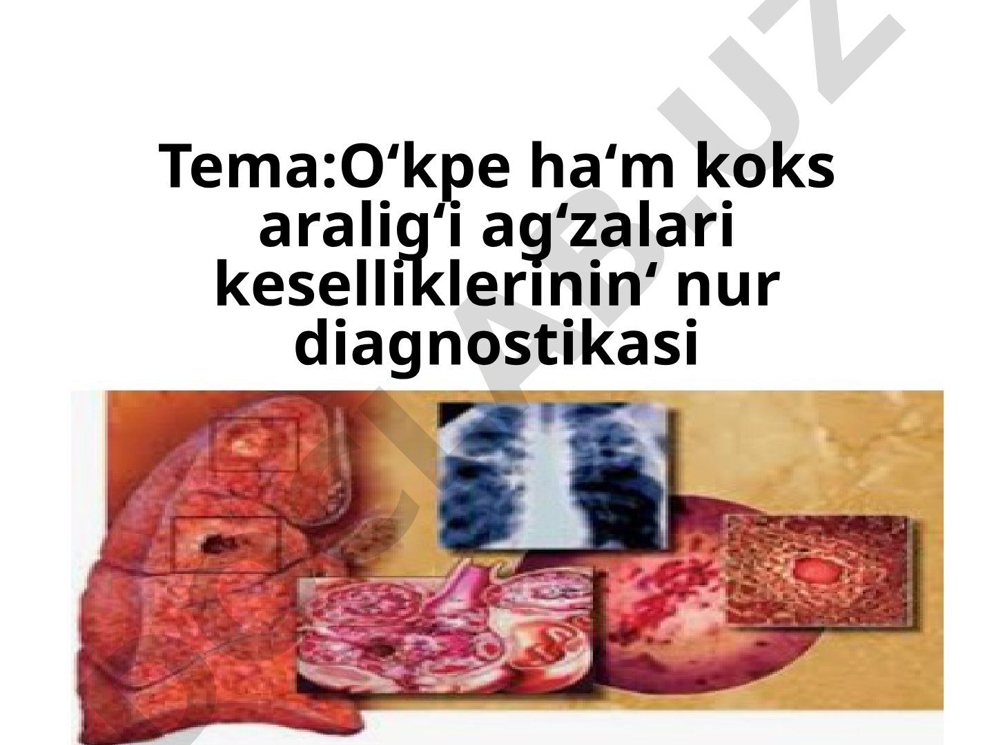 O‘kpe ha‘m koks aralig‘i ag‘zalari keselliklerinin‘ nur diagnostikasi