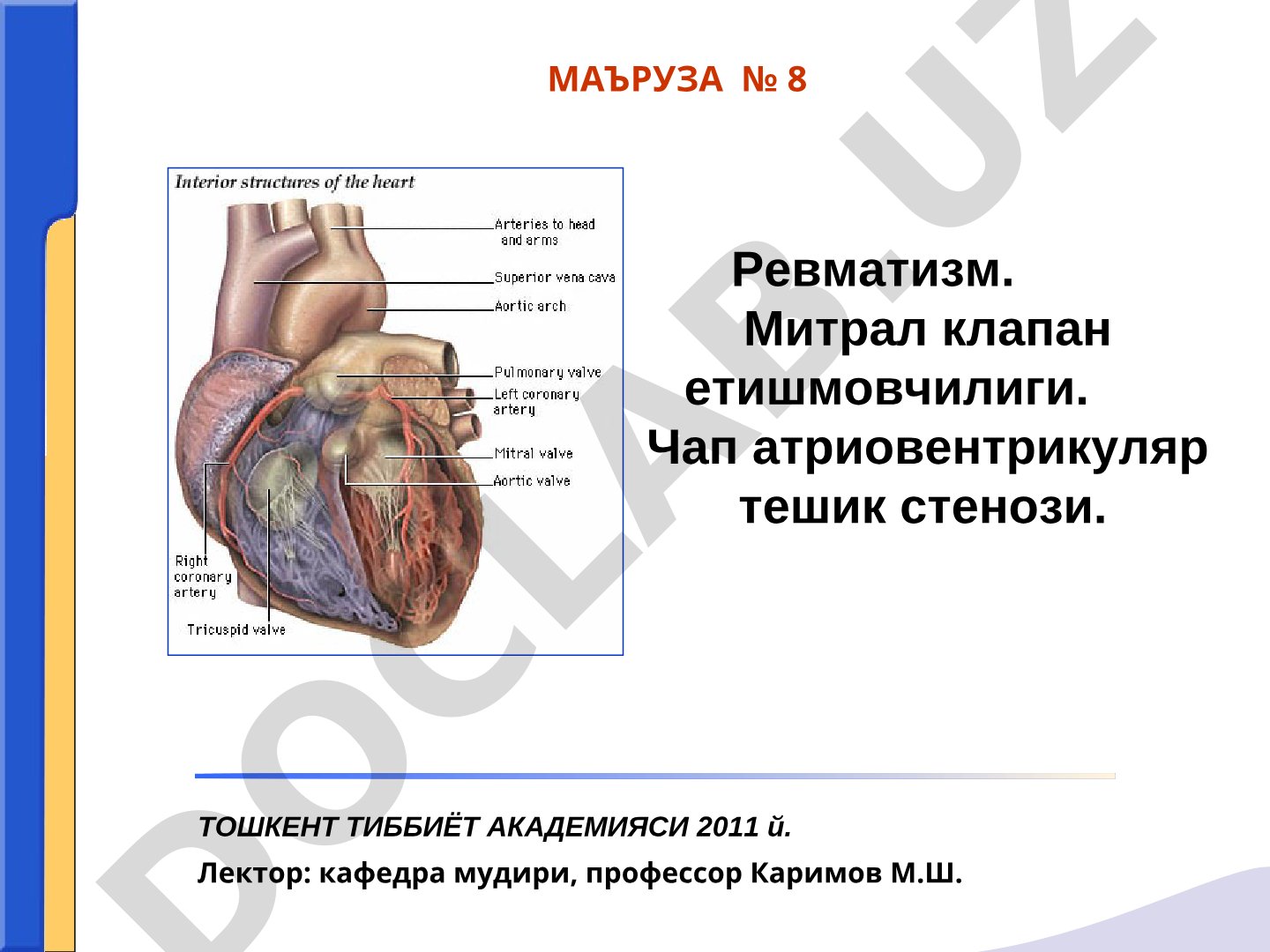 Rеvmatizm, mitral klapan yetishmovchiligi, chap atrioventrikulyar teshik stenozi