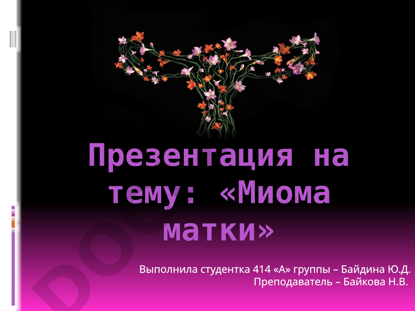 Миома матки