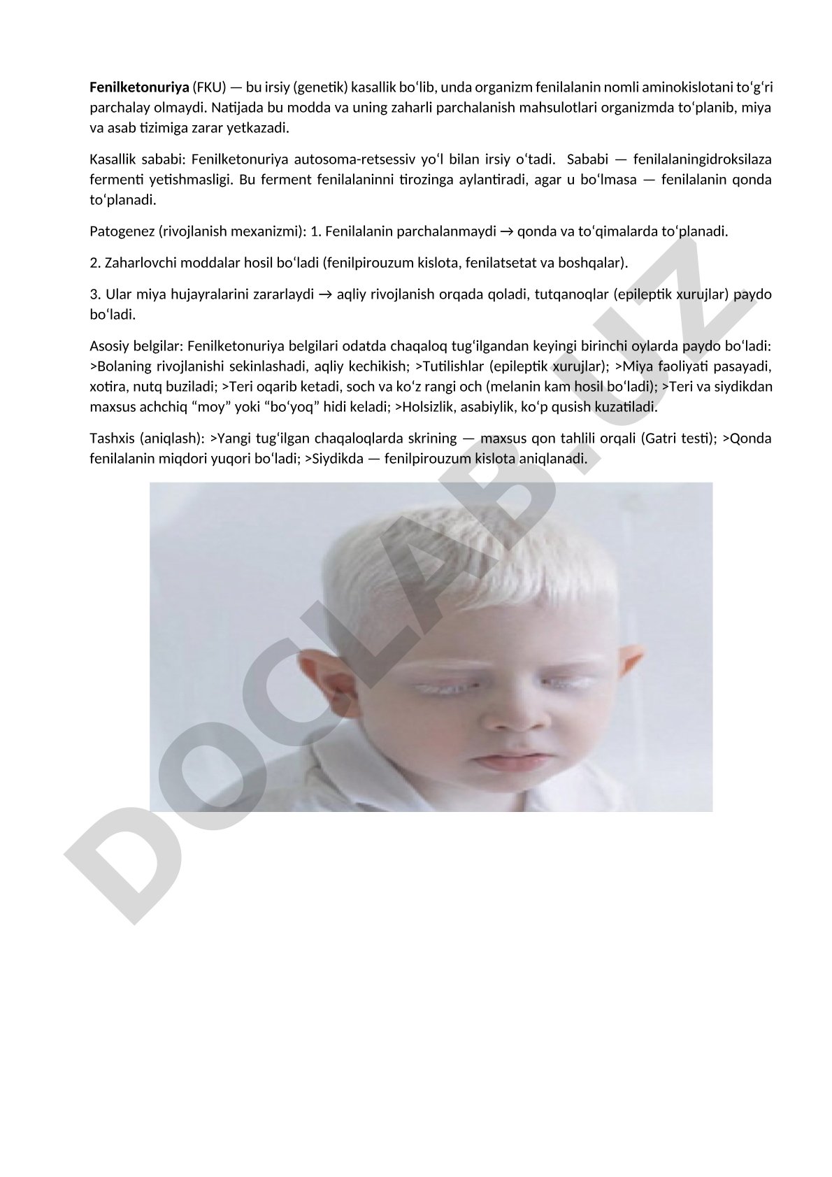 Fenilketonuriya kasalligi: sabablari, patogenezi va belgilari