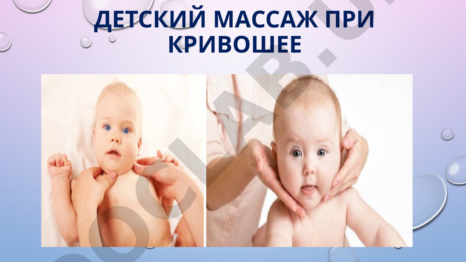Детский массаж при кривошее