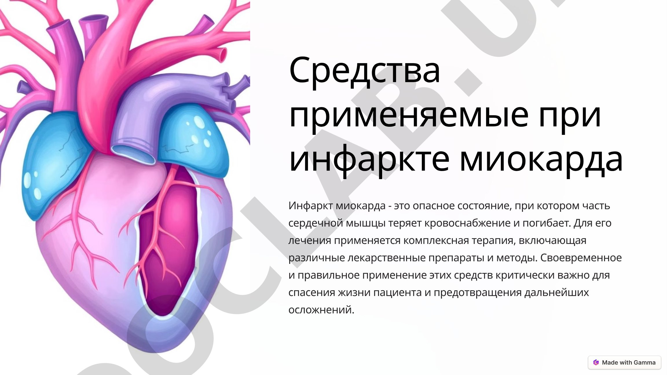 Средства применяемые при инфаркте миокарда