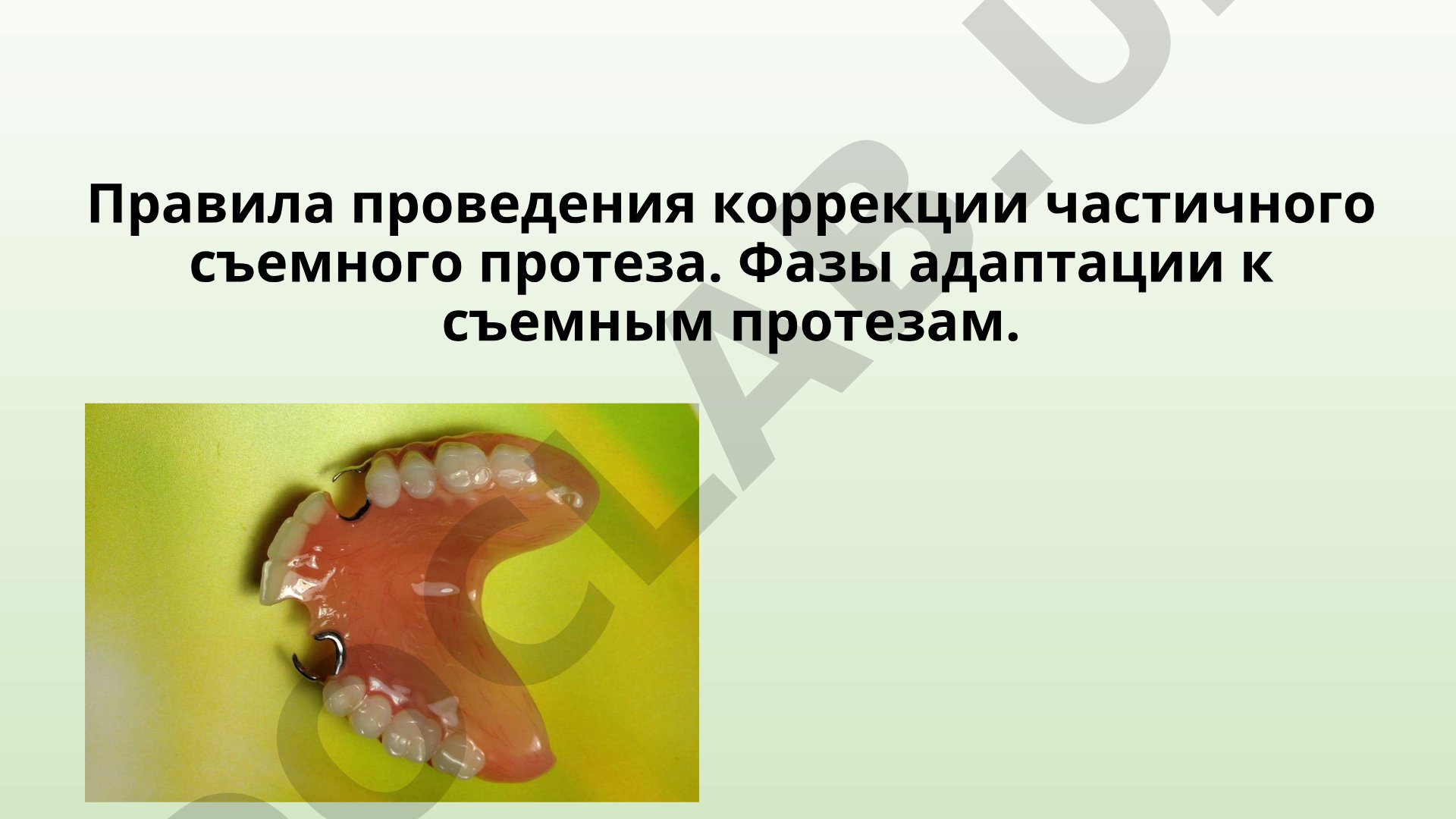 Правила коррекции и припасовки частичных съемных протезов