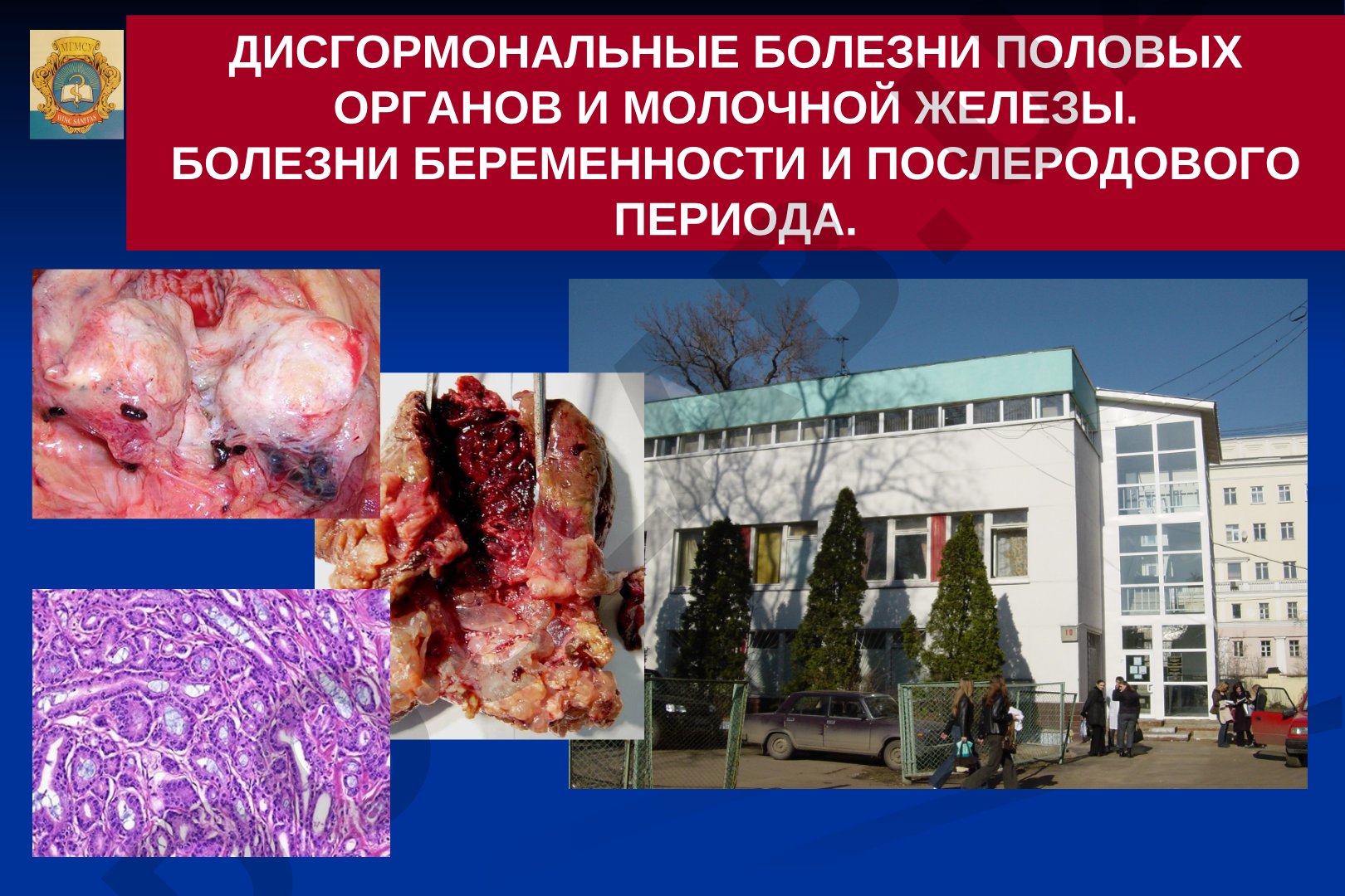 Дисгормональные болезни половых органов и молочной железы, болезни беременности и послеродового периода