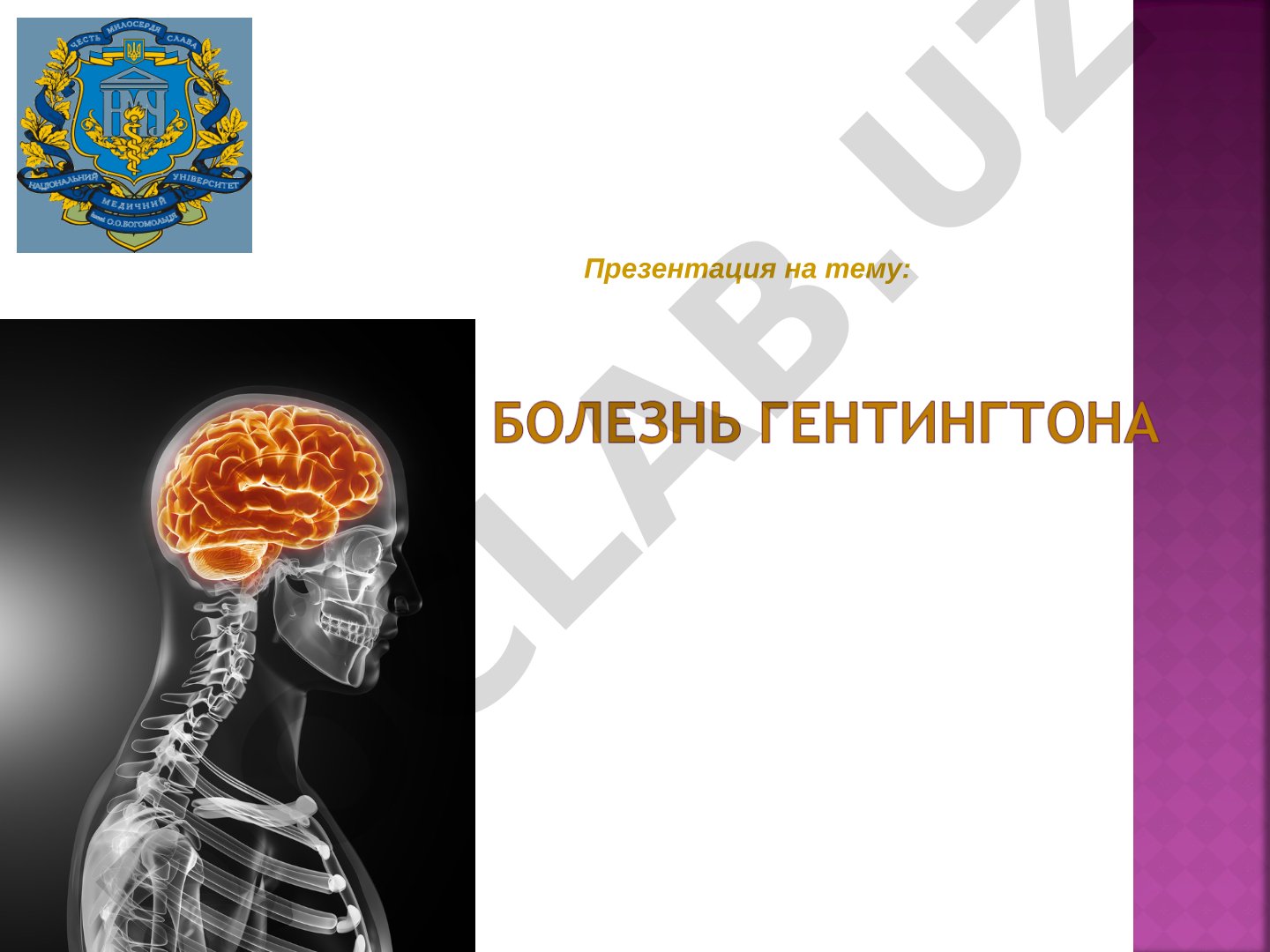 История открытия болезни Гентингтона и описание её симптомов