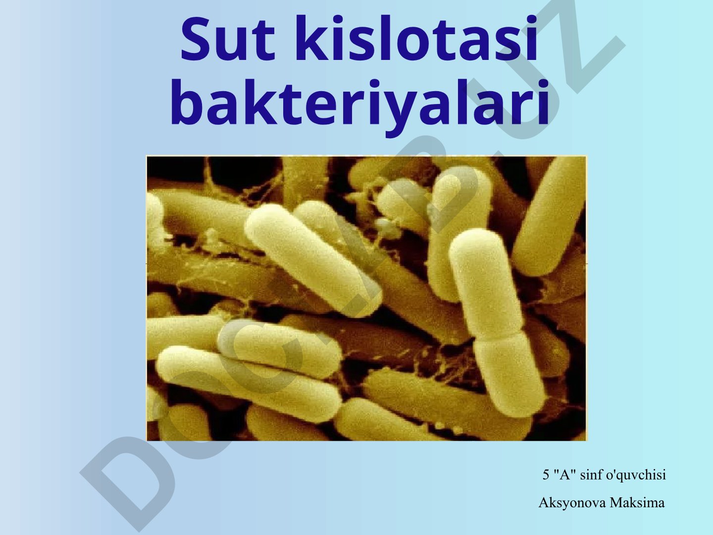 Sut kislotasi bakteriyalari