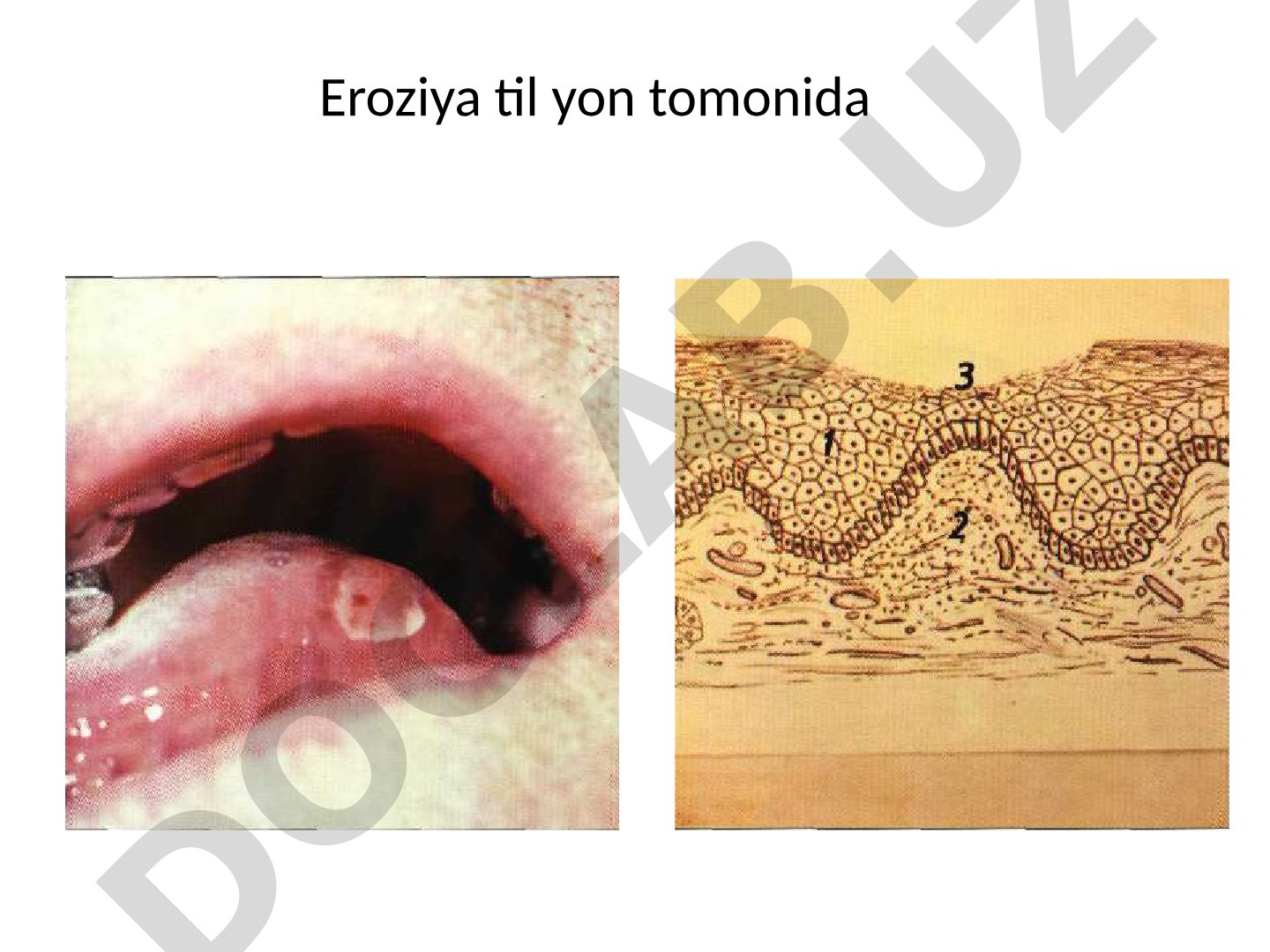 Og'iz bo'shlig'i shilliq qavatidagi patologik holatlar