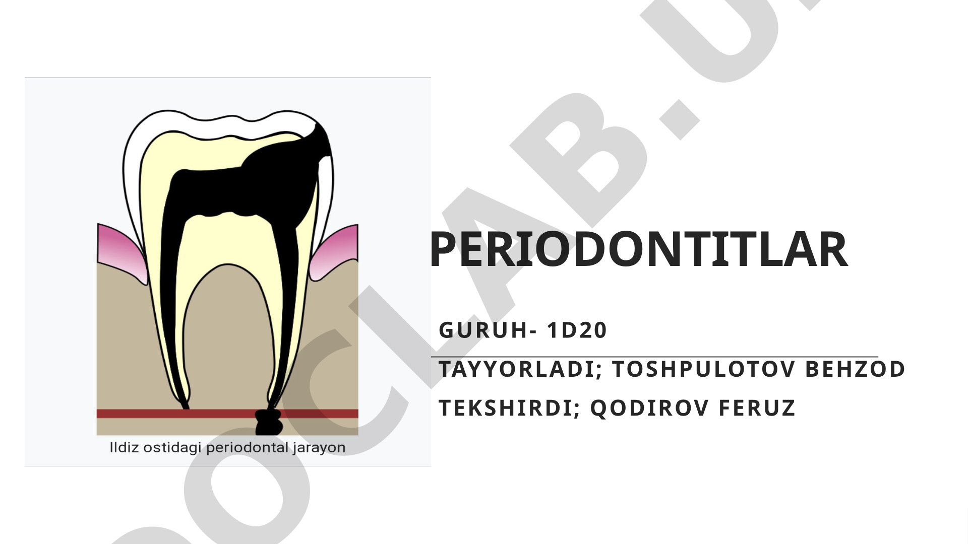 Periodontitlar