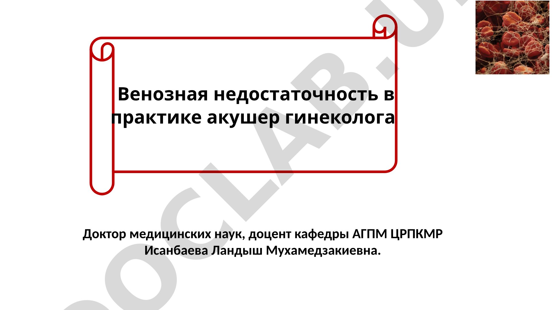 Венозная недостаточность в практике акушер-гинеколога