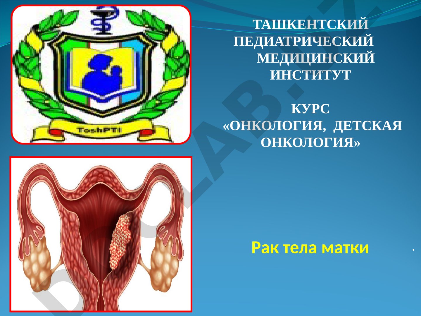 Рак тела матки