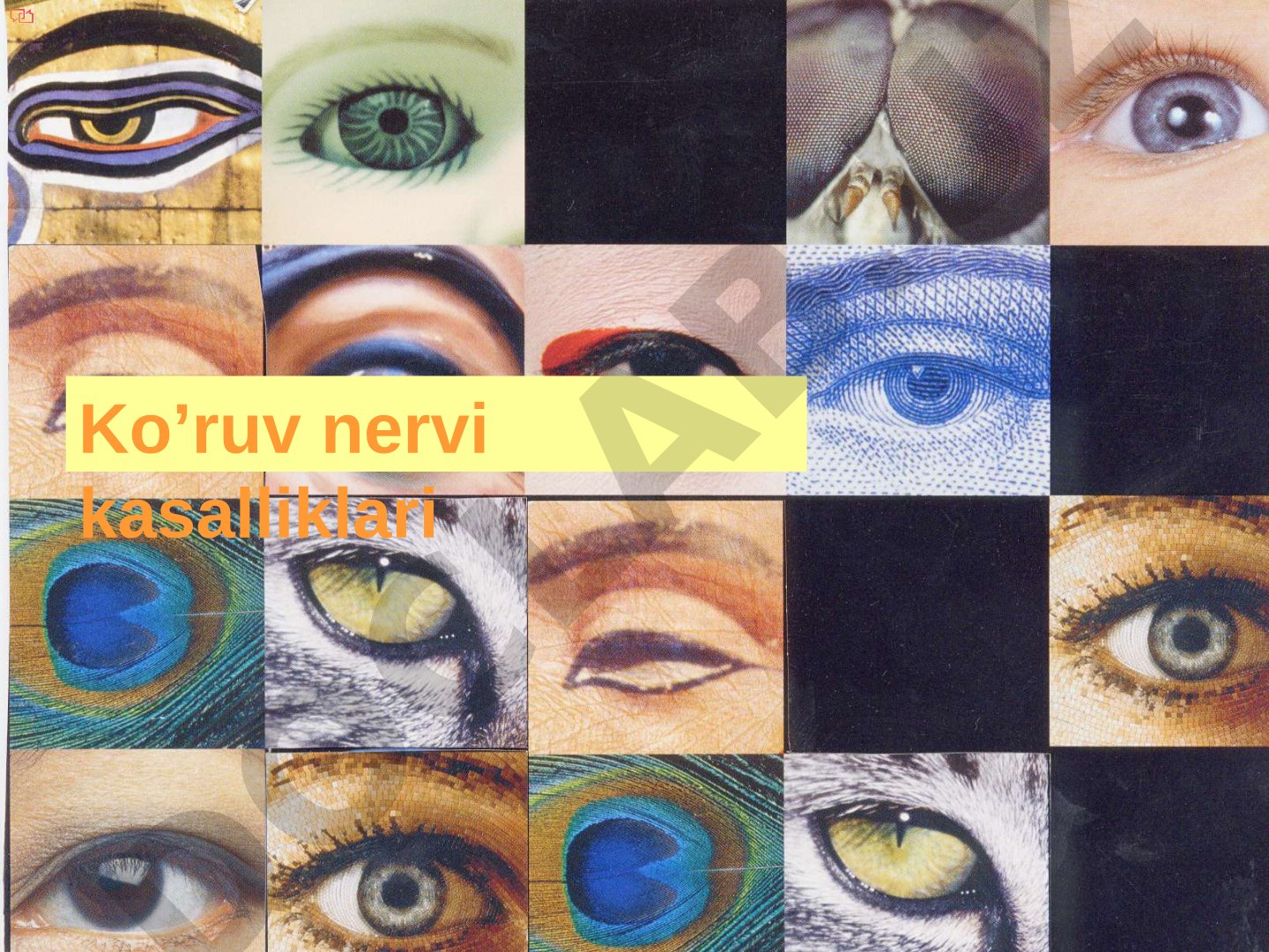 Ko‘ruv nervi kasalliklari