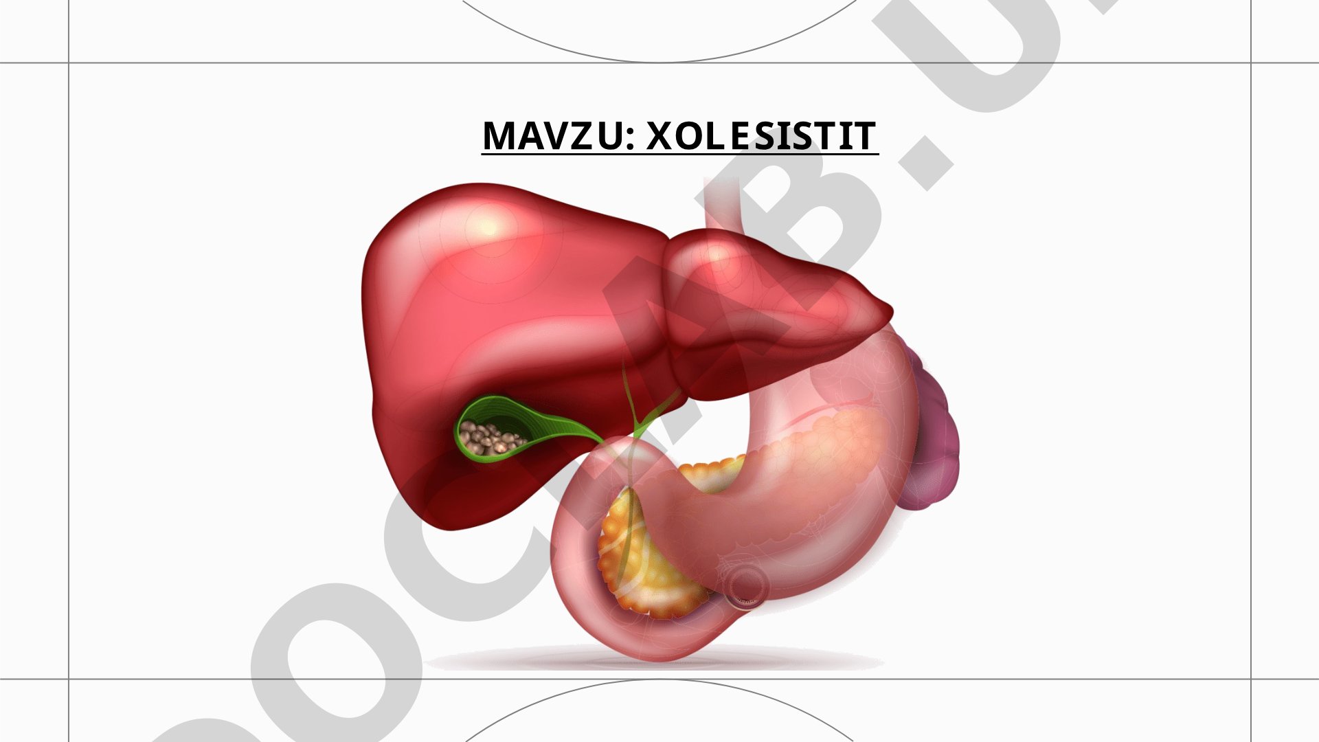 Xoletsistit