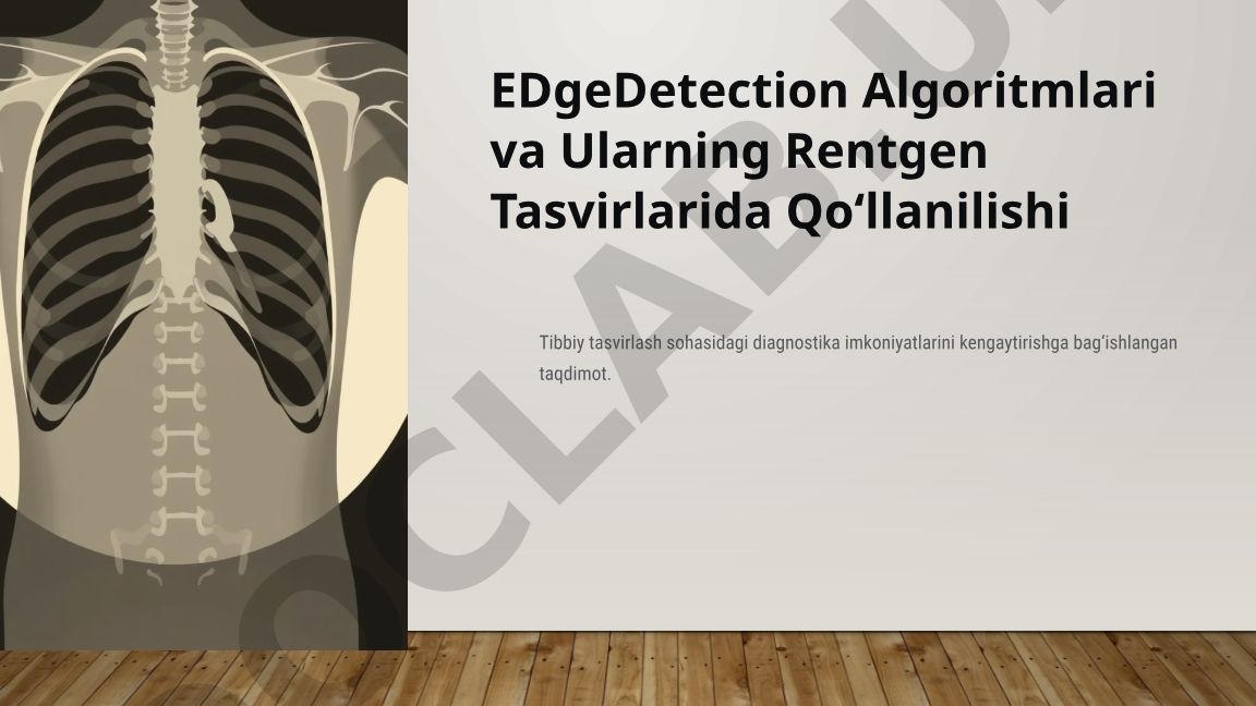 Edge Detection Algoritmlari va Ularning Rentgen Tasvirlarida Qo‘llanilishi