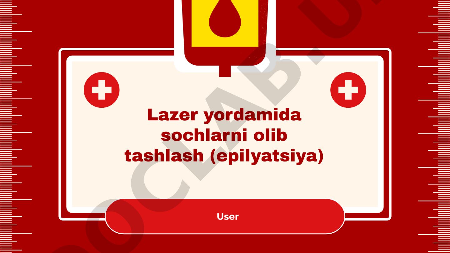 Lazer yordamida sochlarni olib tashlash (epilyatsiya)