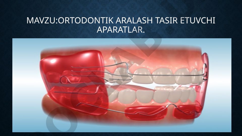 Ortodontik aralash tasir etuvchi aparatlar va ularning tasnifi