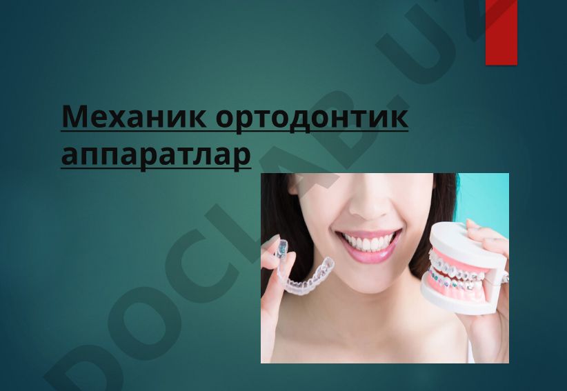 Механик ортодонтик аппаратлар ва уларнинг таснифи