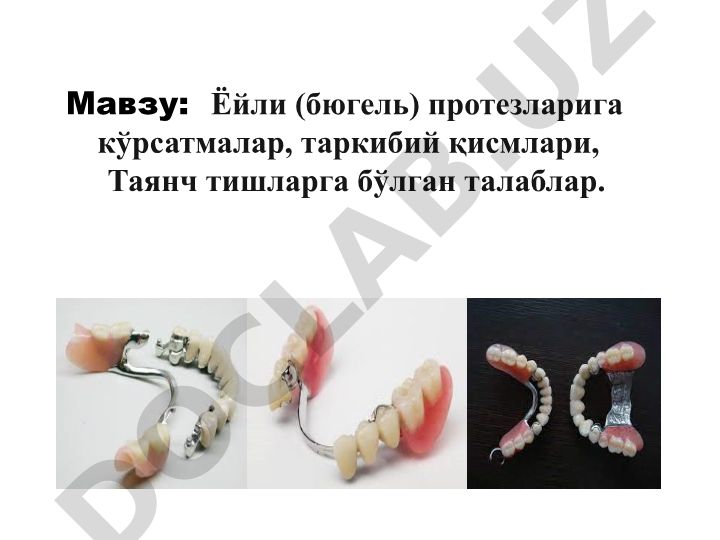 Ёйли (бюгель) протезларига кўрсатмалар, таркибий қисмлари ва талаблар