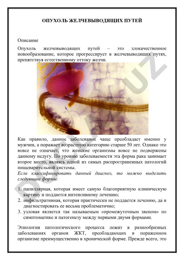 Опухоль желчевыводящих путей