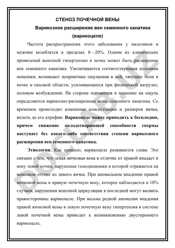 Стеноз почечной вены и варикоцеле